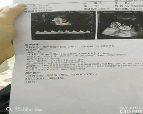 温州代孕捐卵试管婴儿_温州有代孕有宝宝的吗_温州代孕的地方