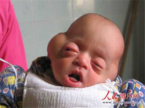 天津供卵选性别_做试管婴儿需多少钱，一代试管会便宜很多？