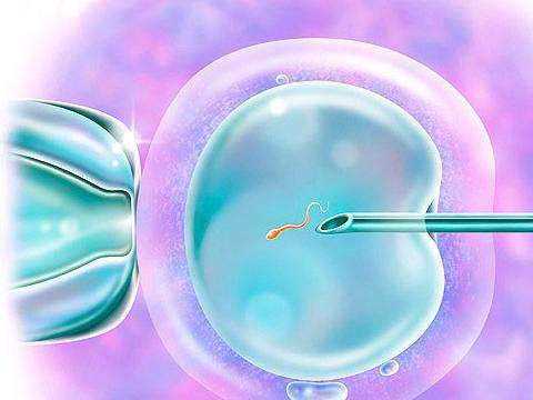 逆行射精_胎停9染色体异常_乌克兰助孕做试管婴儿前为什么要进行术前检查呢？